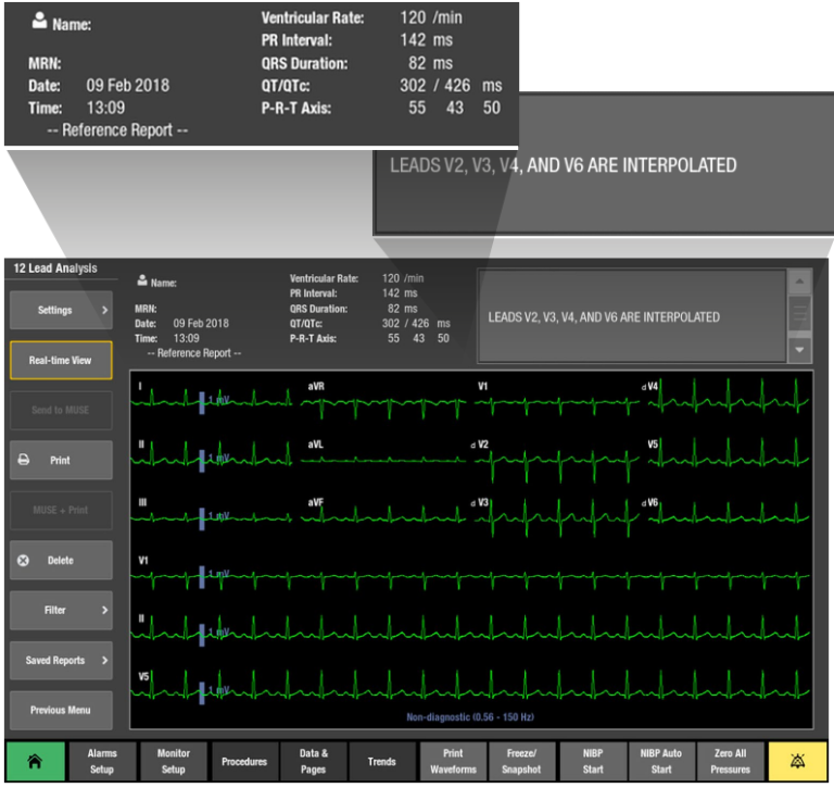 A view of a 12RL report on the monitor screen