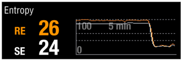 Clinical use of entropy step 3