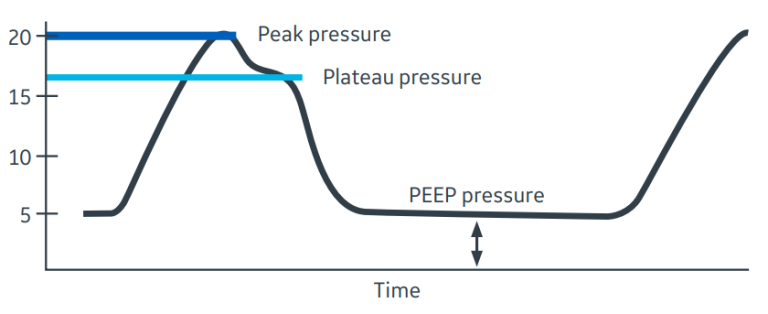 Driving Pressure