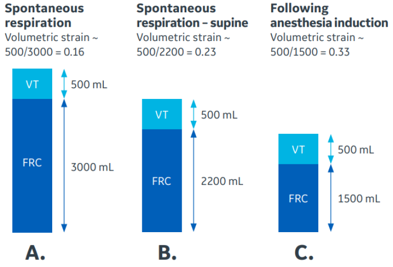 Effect of reduced functional residual capacity on lung strain