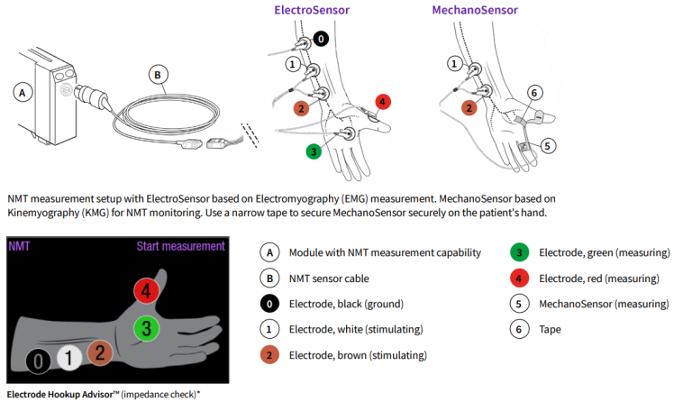 NMT module with ElectroSensor and MechanoSensor