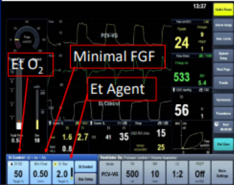 EtC GE Aisys Screenshot