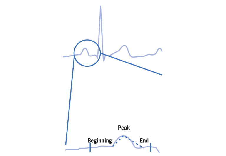 P-wave detection