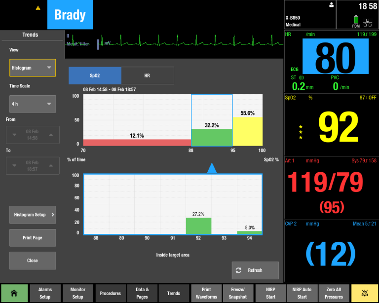 Histogram NICU