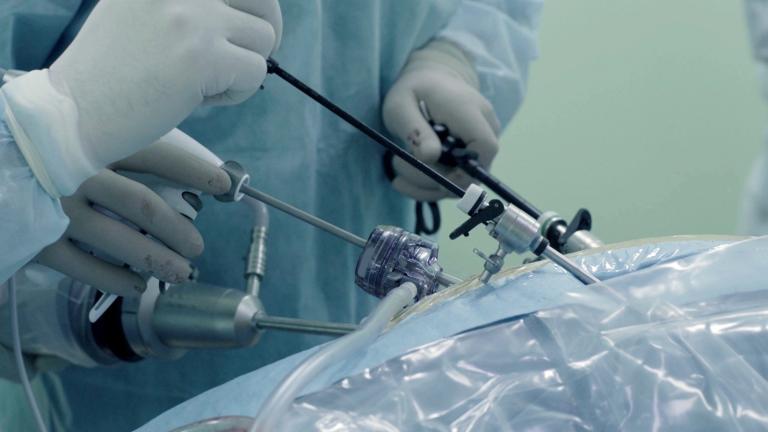 Two clinicians performing laparoscopic surgery on a patient