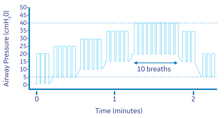 Changes in airway pressure with time
