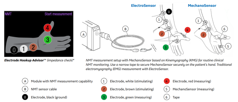 NMT device setup
