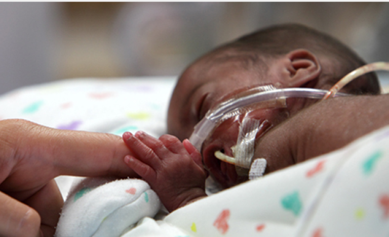 Neonatal patient under respiratory support