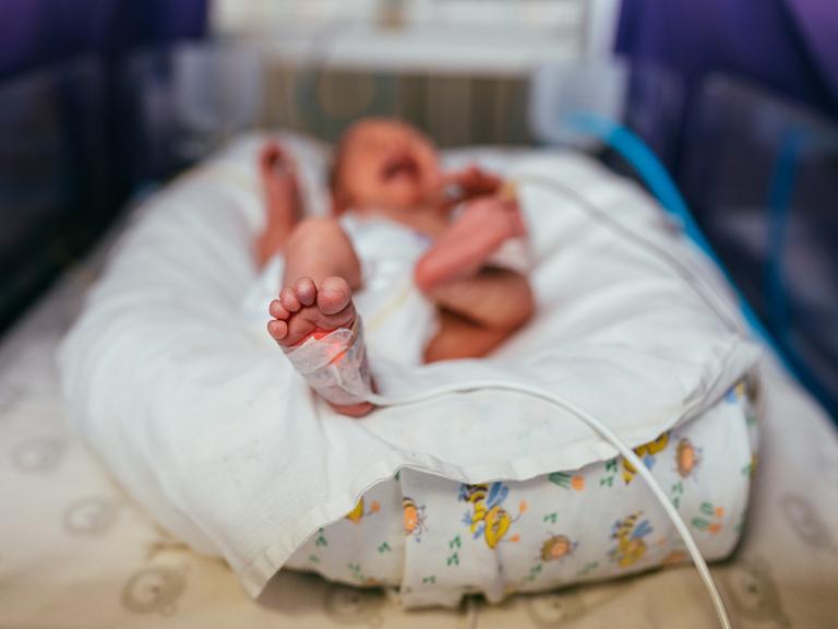 Newborn in a warmer in the NICU