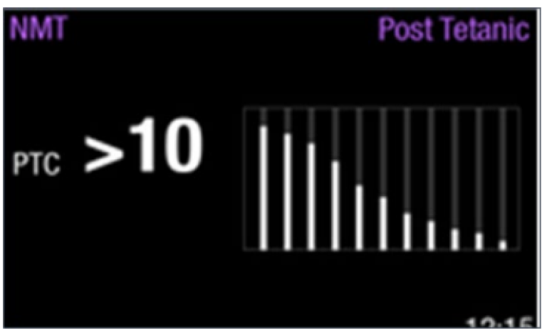 Post Tetanic Count (PTC)