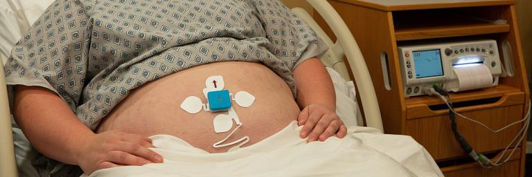 Pregnant woman attached to fetal monitor