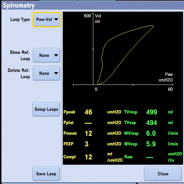 Spirometry screen