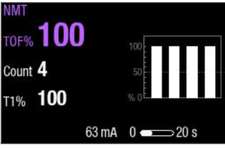 Step 1 to monitor neuromuscular block