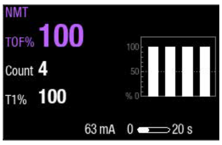 Step 1 to monitor neuromuscular block