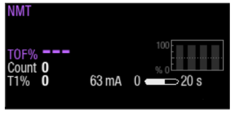 Step 3 to monitor neuromuscular block