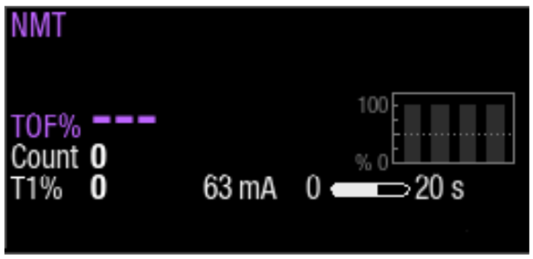 Step 3 to monitor neuromuscular block.