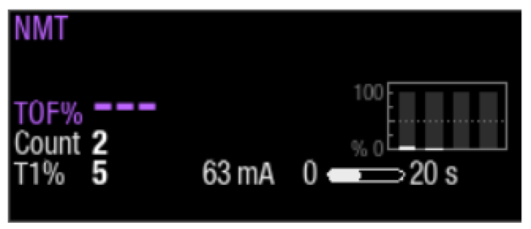 Step 4 to monitor neuromuscular block