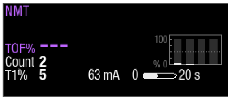 Step 4 to monitor neuromuscular block