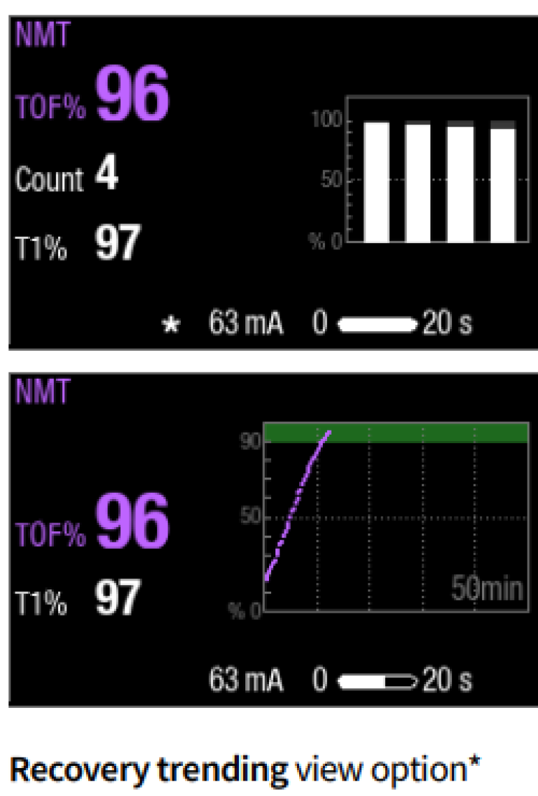 Step 5 to monitor neuromuscular block