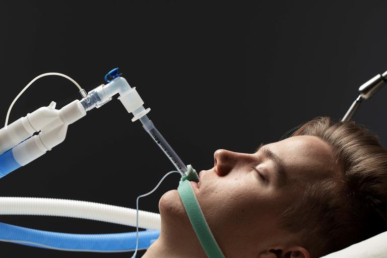 Intubated patient