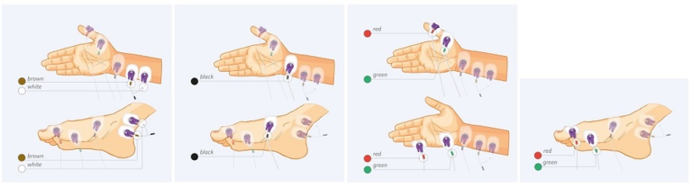 NMT sensor positioning