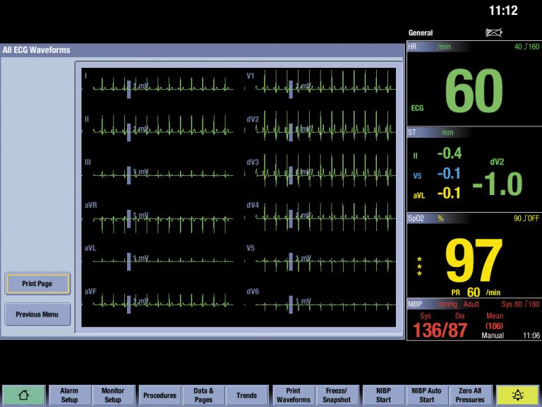 ecg led ho m6