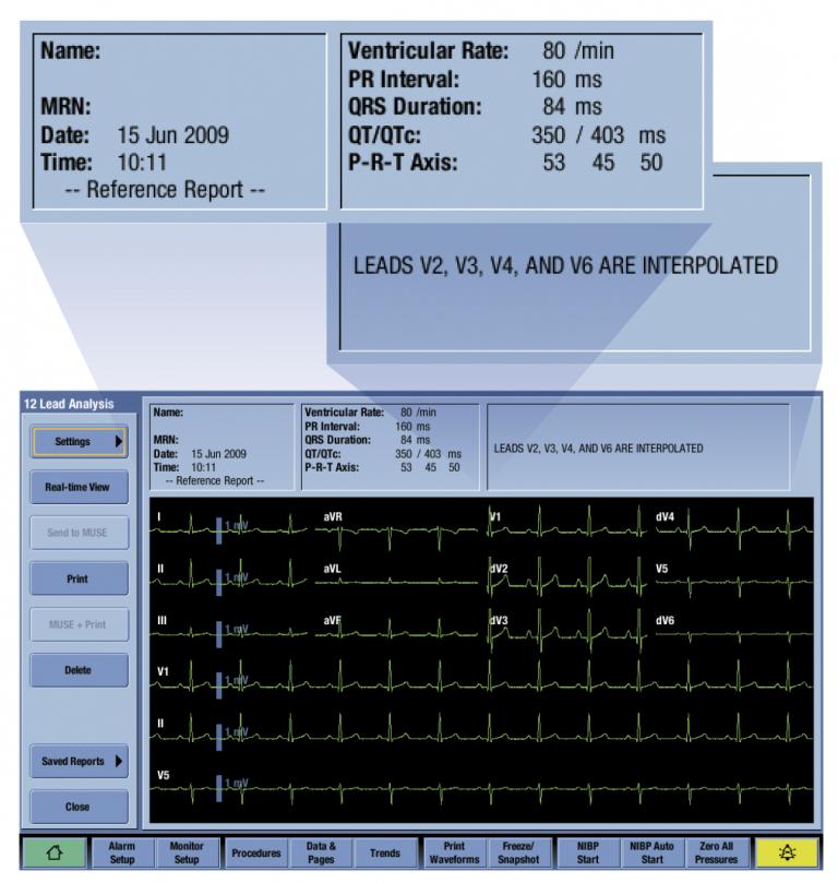 A view of a 12RL report on the monitor screen