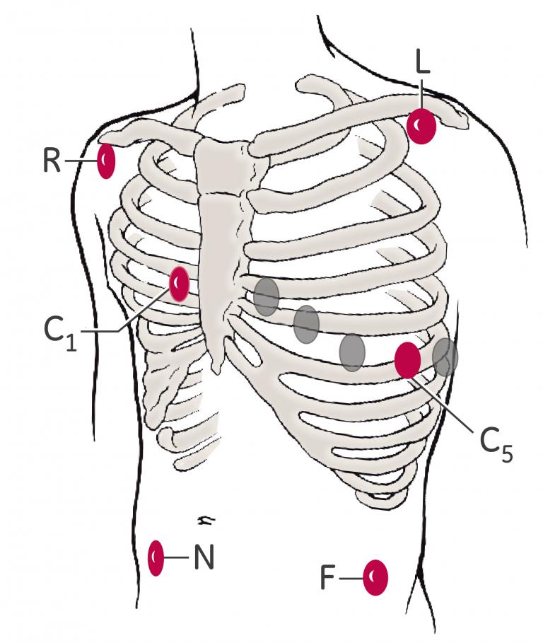 6 Lead Configuration IEC