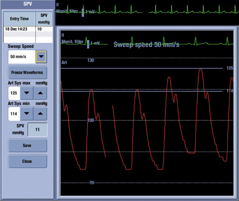 SPV screen