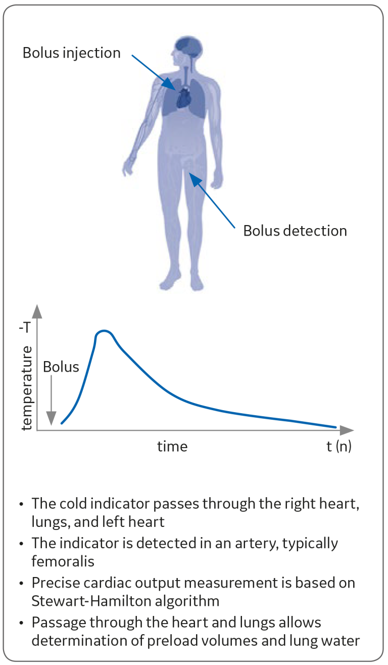 Transpulmonary thermodilution