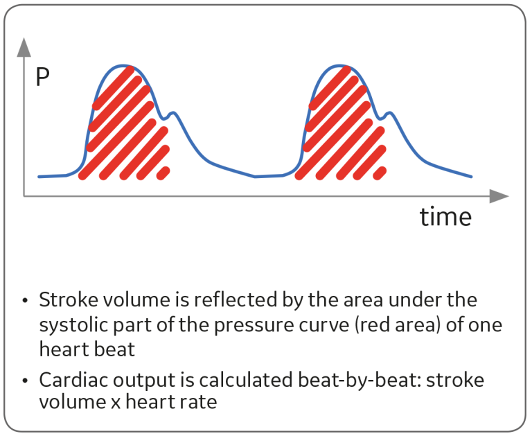 Pulse contour analysis