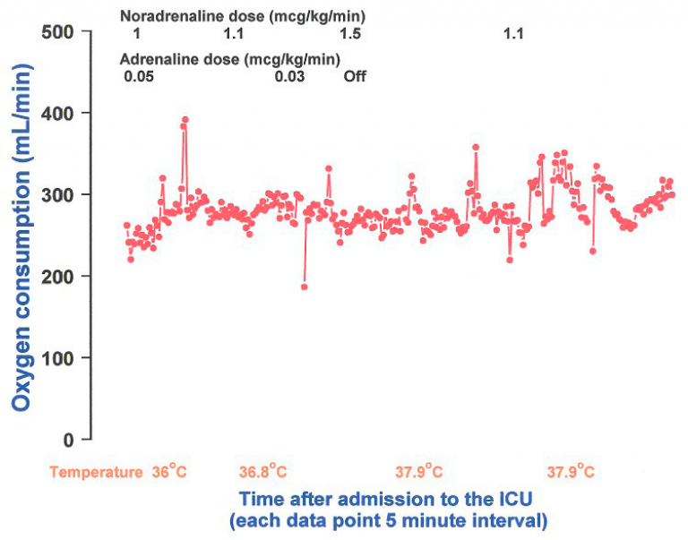 Metabolic data of a 74 year old patient admitted in the ICU post-operatively