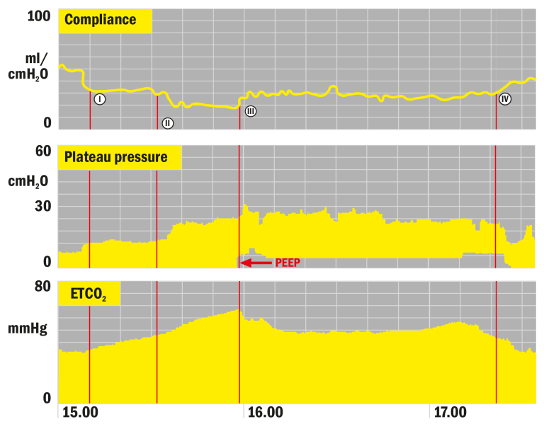Combined Patient Spirometry