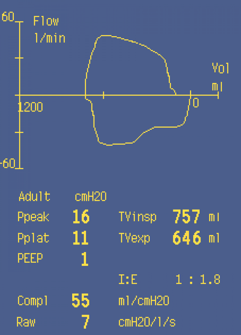 Leak in the airway
