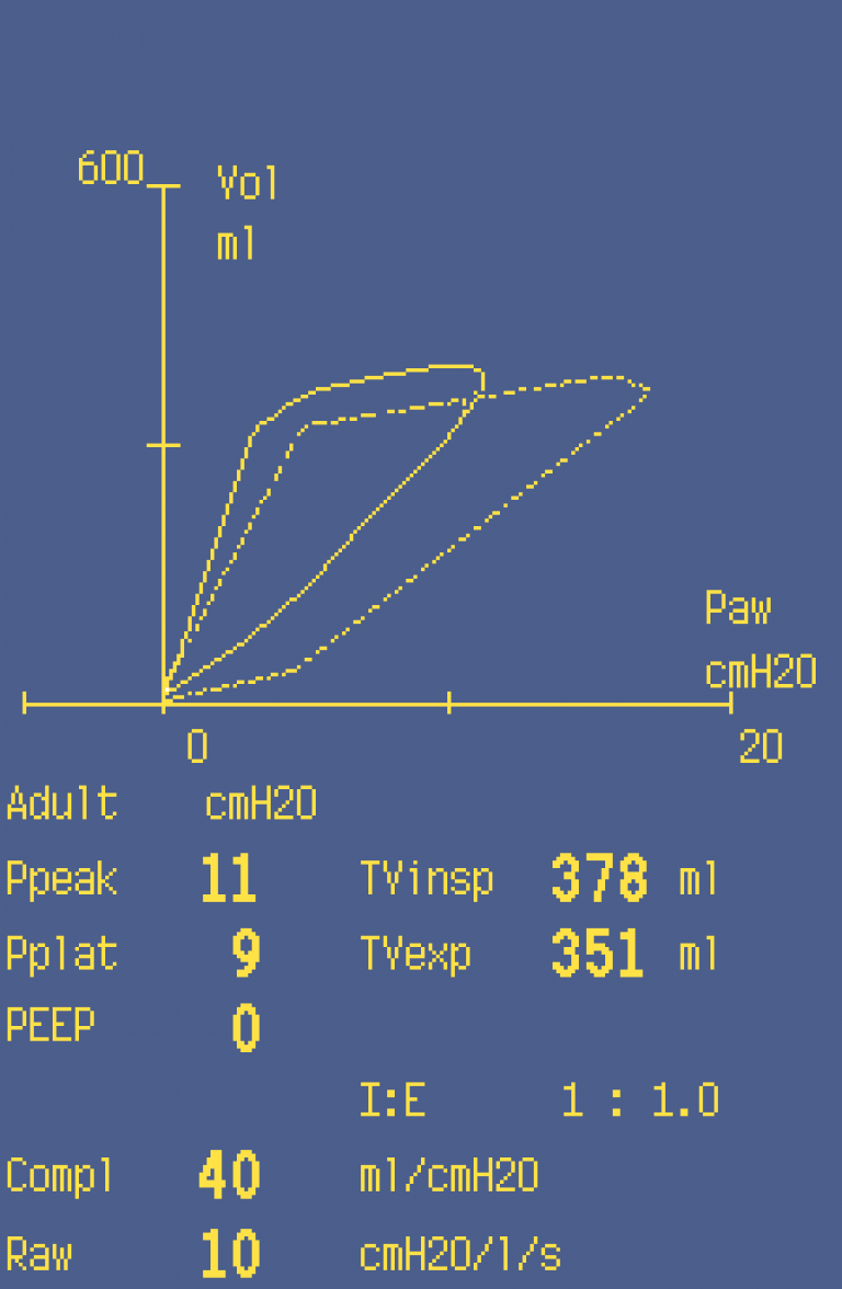 Monitoring of changes during lapa-roscopy