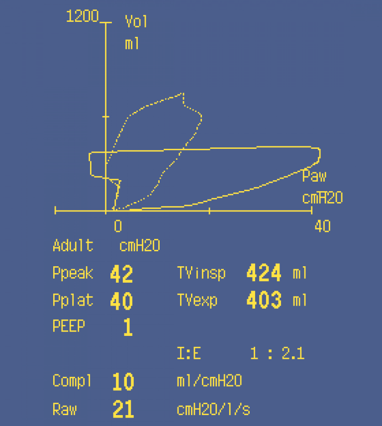 Obstruction in the airway
