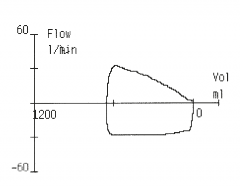 Flow/Volume Loop