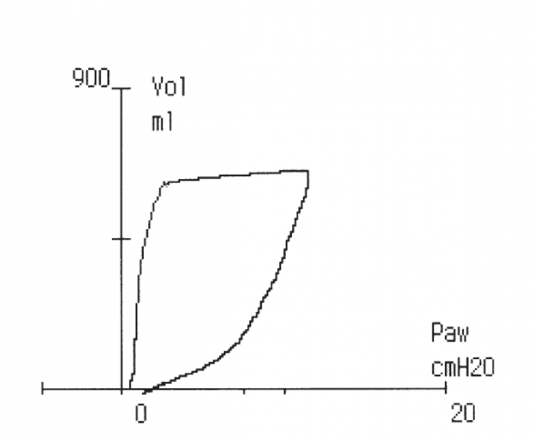 Pressure / Volume Loop