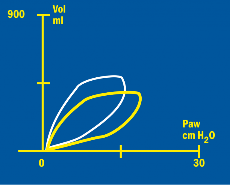 Volume/Pressure loop changed status