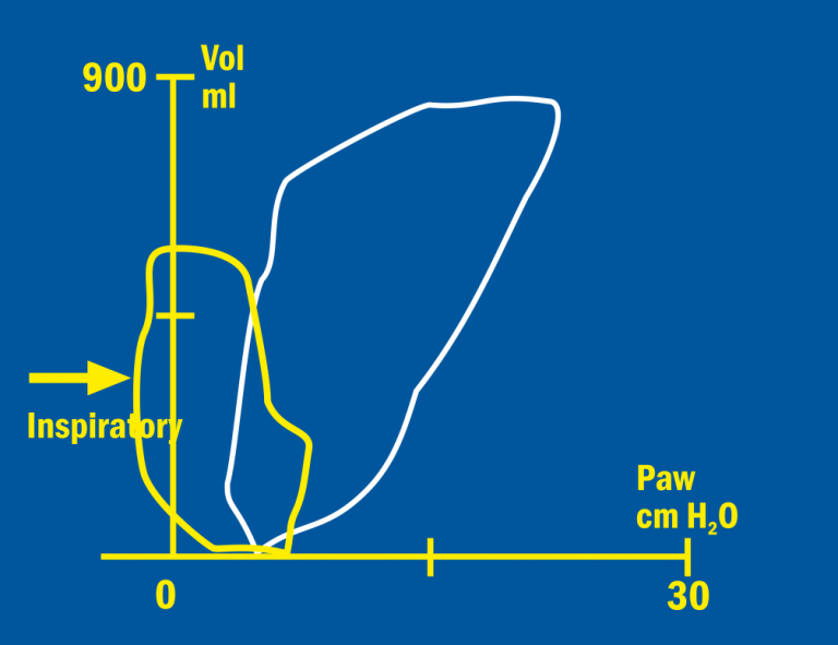 Spontaneous breathing Volume/Pressure loop
