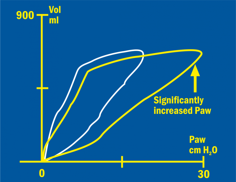 Pressure/Volume loop of an unintentional one-lung intubation
