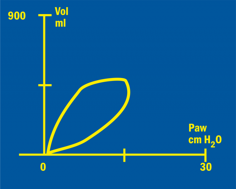 Initial status of a Pressure/Volume loop 