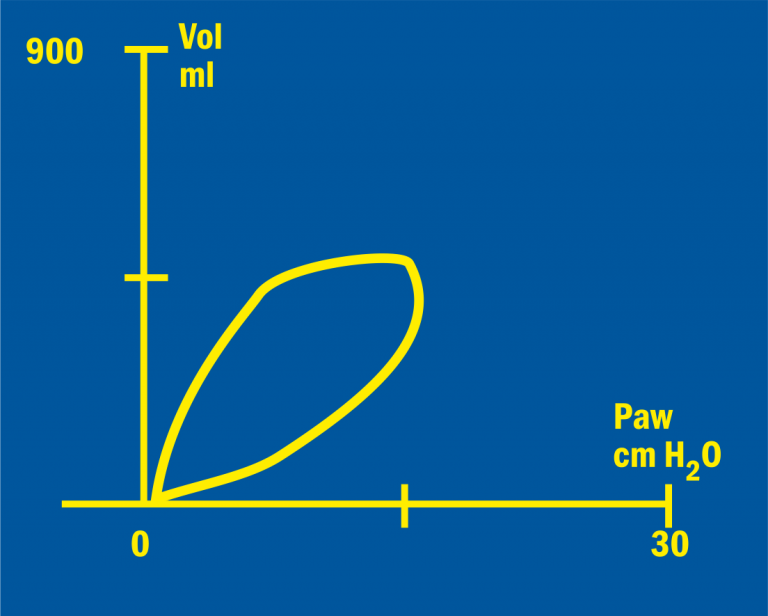 Initial status of a Pressure/Volume loop