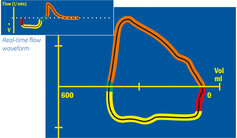 Flow-Volume Loop
