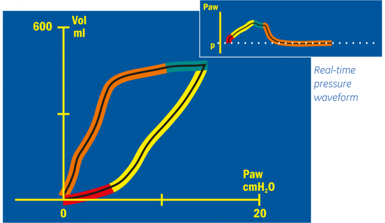 Pressure Volume Loop