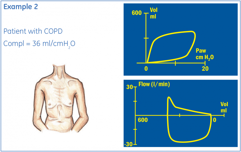 Individual loop example 2