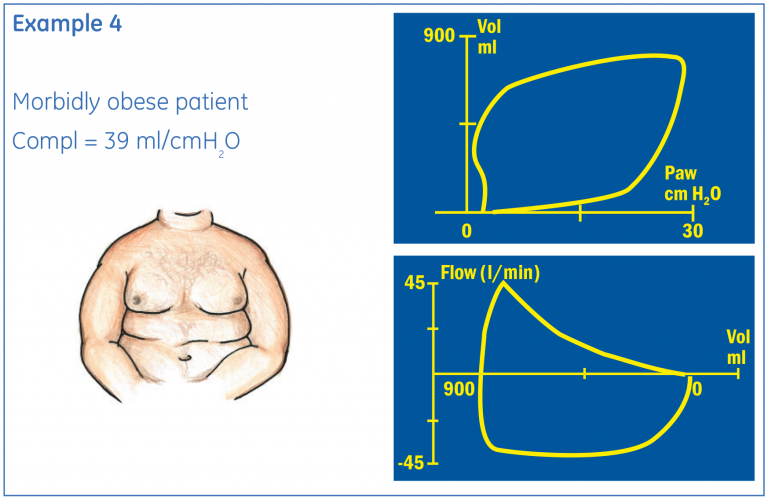 Individual loop example 4