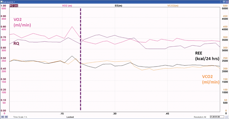 V̇CO₂, RQ, and REE values before and after steady state is achieved