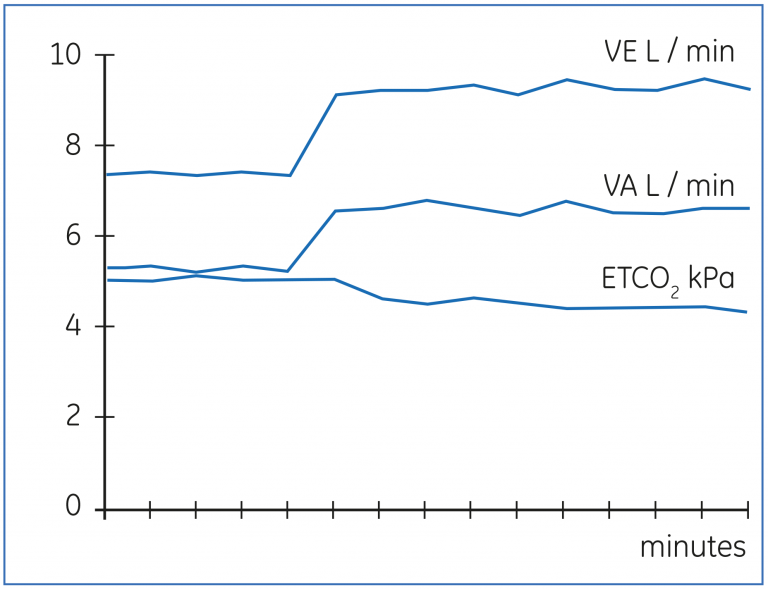  Change in VA in response to increased minute ventilation. 