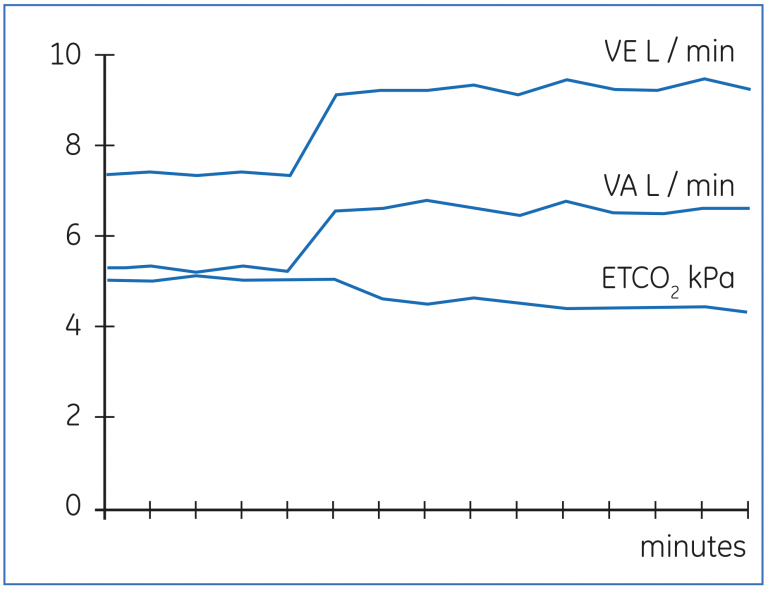 Change in VA in response to increased minute ventilation.